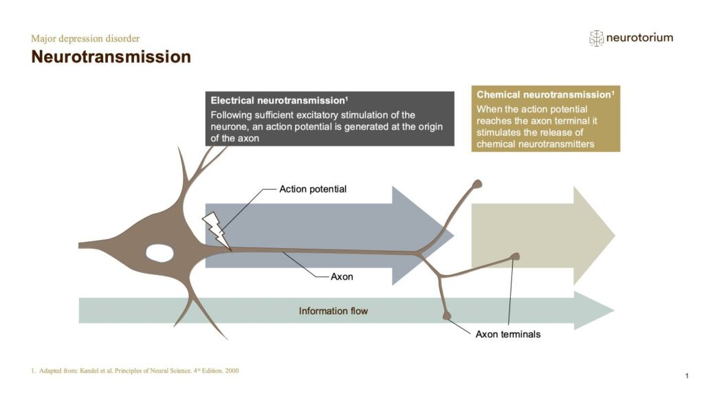 Major Depressive Disorder - Neurobiology and Aetiology - slide 9
